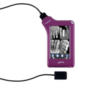MyRay X-pod Xray Viewer
