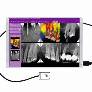 MyRay ZenX E Sensor